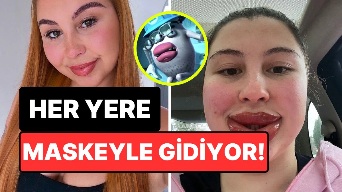 Kalıcı Makyaj Yüzünden Alerjik Tepkiyle Farklı Birine Dönüşen Kadın
