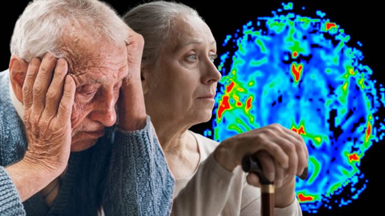 Virüsü Geride Bıraktınız Ama Zihniniz Risk Altında! Bilim Adamlarından Korkutucu Alzheimer İkazı