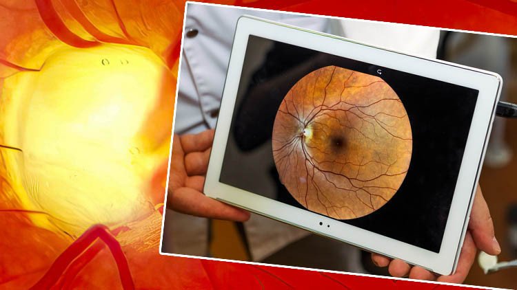 Uzmanlardan Uyarı: Bu Hastalık Beklenenden Daha Yaygın! Gizlice Yayılıyor