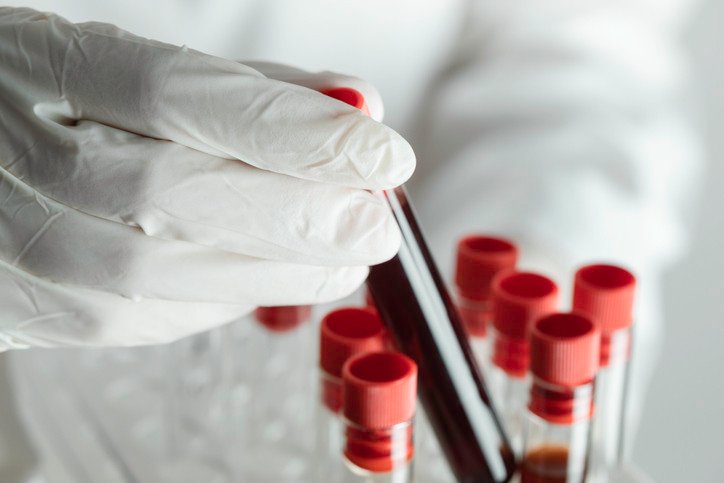 Gençlik' Bu Proteinlerde Gizli Olabilir Mi? Uzun Yaşamanın Anahtarı Kanımızda mı?