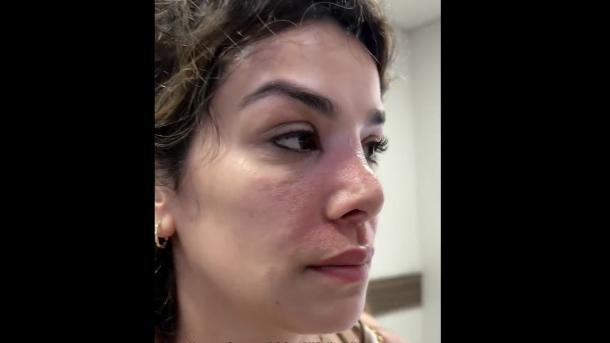 Bali Tatilinde Kâbus: Kirli Sudan Mikrop Kapan Genç Kadın Hastane Sürecini Anlattı