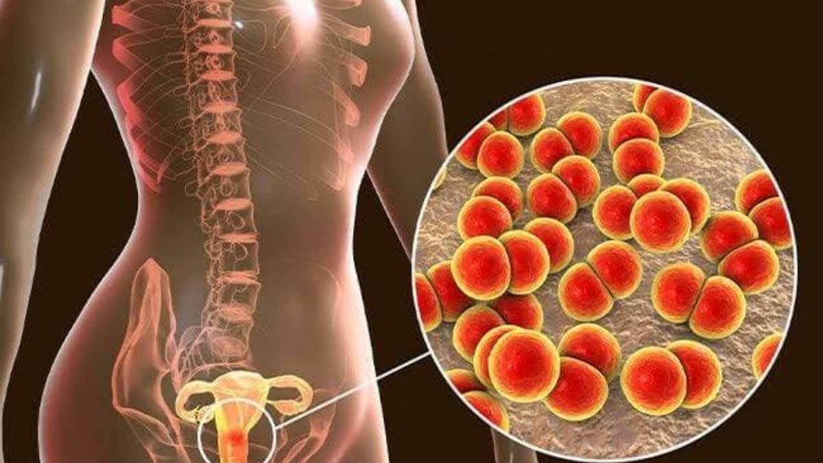 Cinsel Yolla Bulaşan Hastalıklar Nelerdir? Belirtileri, Bulaşma Yolları Ve Korunma Yöntemleri